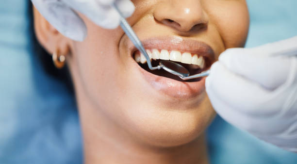 Best Emergency Treatment for Dental Infections or Abscesses in Commerce, GA